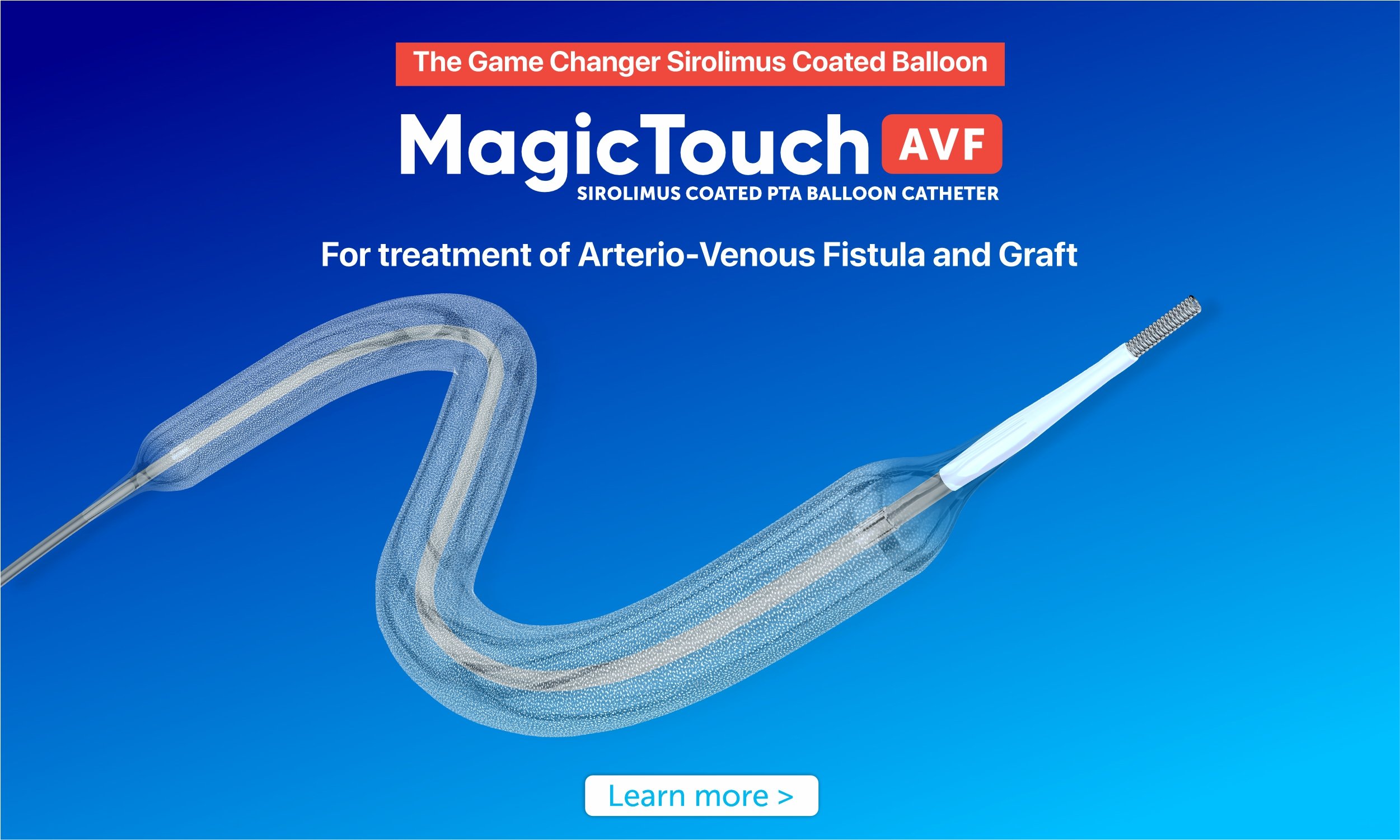 MagicTouch AVF 